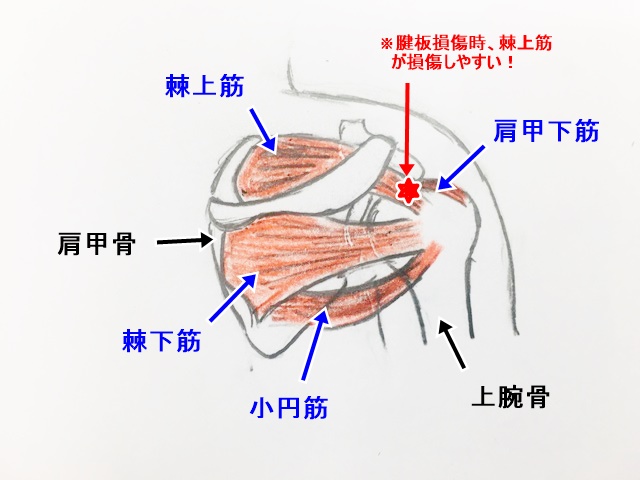 損傷 腱 板 「肩腱板断裂」｜日本整形外科学会 症状・病気をしらべる
