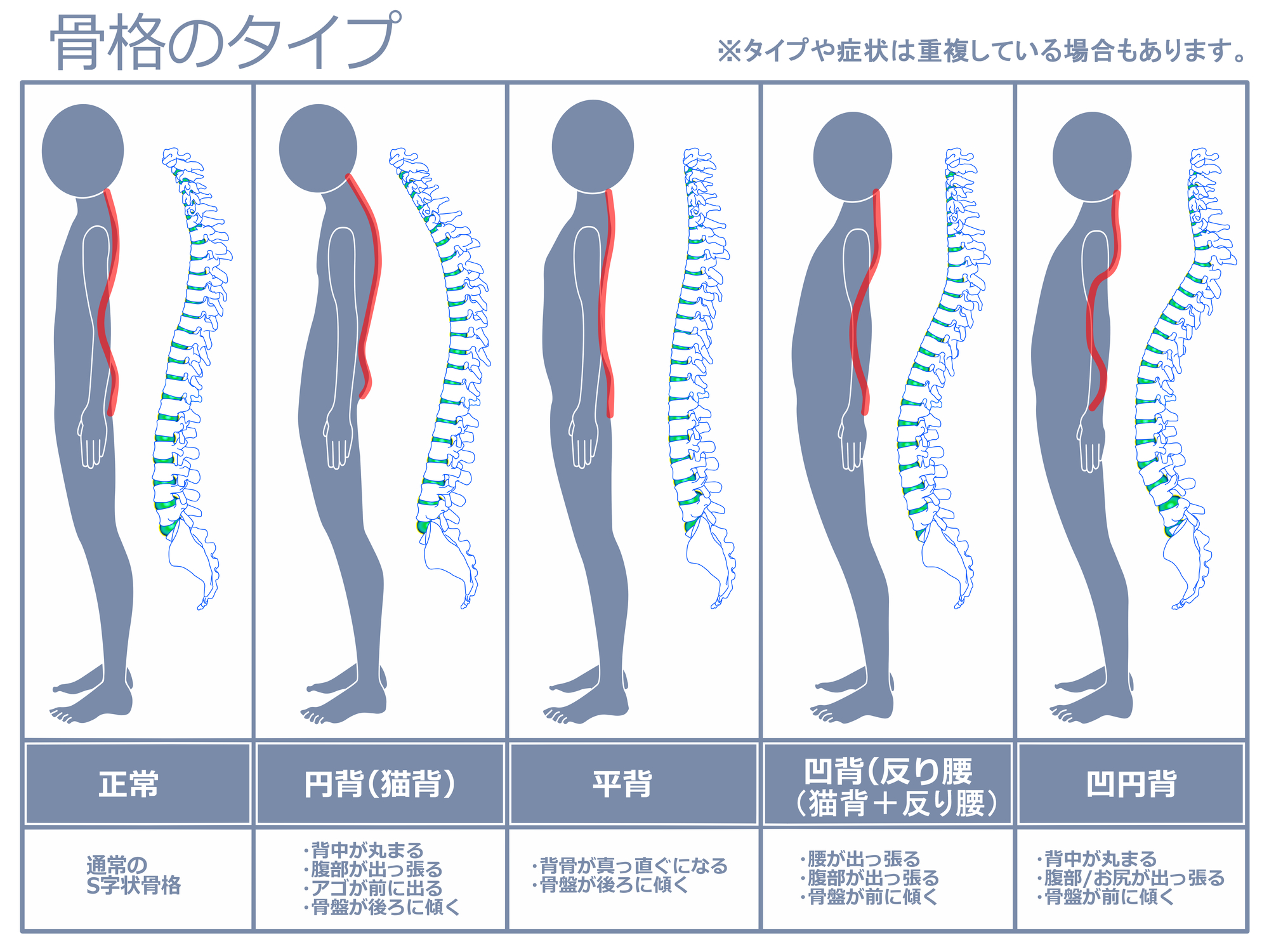 脊柱の歪みについて説明します。 | 神戸元町リリーフ整体院